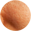 Big Pores